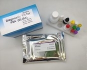 کیت تست خانگی 96 تکه آنتی ژن هسته ویروس هپاتیت B Elisa با کارایی بالا