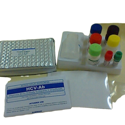 کیت تشخیص Interleukin 1 Beta elisa Human Il1b Elisa Kit Reaserch استفاده